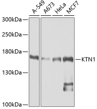 KTN1 Polyclonal Antibody (E-AB-62116)