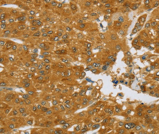 TNFSF13 Polyclonal Antibody (E-AB-16931)