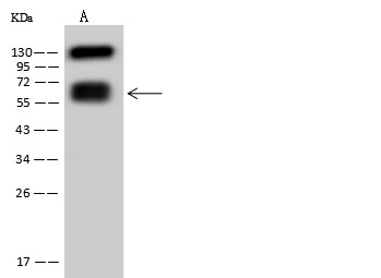 CD19 Monoclonal Antibody (AN200122P)