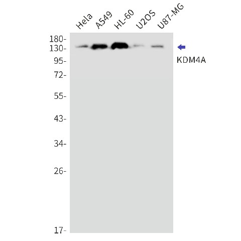 Recombinant KDM4A Monoclonal Antibody (E-AB-81576)