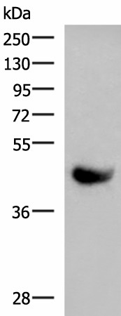 KIR2DL5A Polyclonal Antibody (E-AB-18184)
