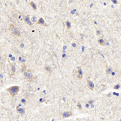 DLL3 Polyclonal Antibody (E-AB-70188)