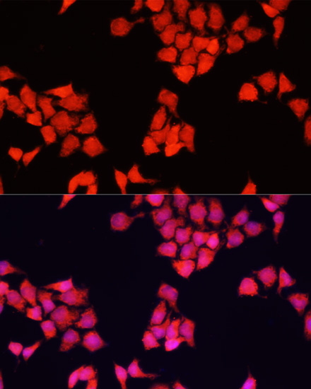 FXR1 Polyclonal Antibody (E-AB-66823)