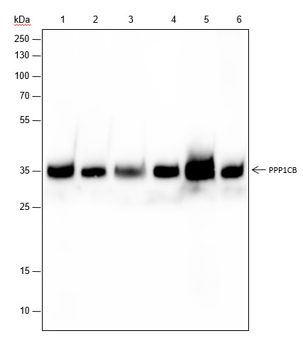 Recombinant PPP1CB Monoclonal Antibody (AN301634L)