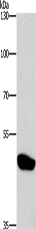 CTBP1 Polyclonal Antibody (E-AB-13175)