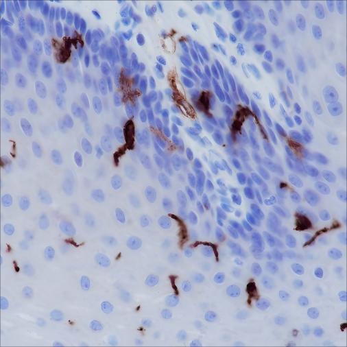 Recombinant CD1a Monoclonal Antibody (AN301468L)