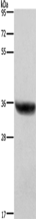 HSD17B1 Polyclonal Antibody (E-AB-13312)