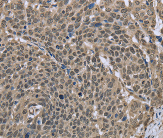 DCTN4 Polyclonal Antibody (E-AB-14938)