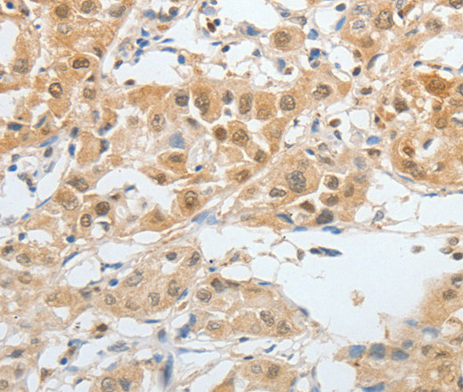 BPIFB2 Polyclonal Antibody (E-AB-15756)