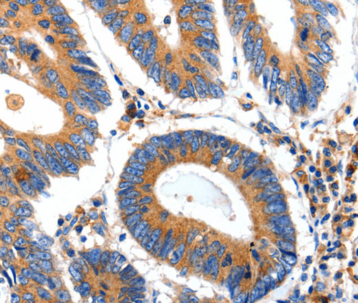 IGFBP7 Polyclonal Antibody (E-AB-12517)