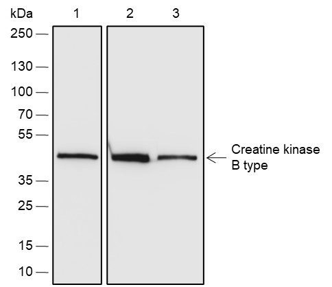 Recombinant Creatine kinase B type Monoclonal Antibody (AN301963L)