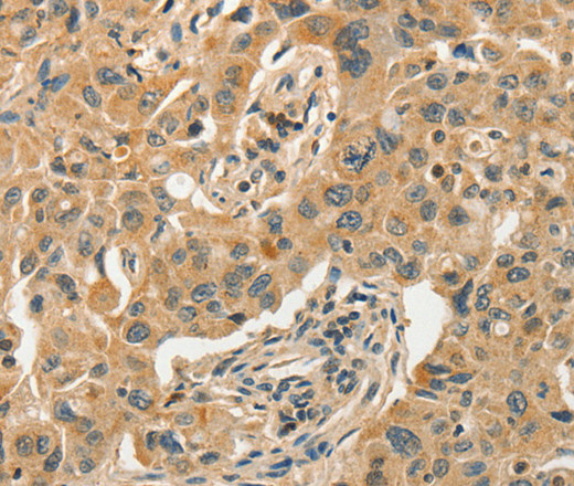 SLC11A2 Polyclonal Antibody (E-AB-13200)