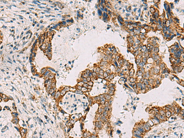 PDHA1 Polyclonal Antibody (E-AB-19017)