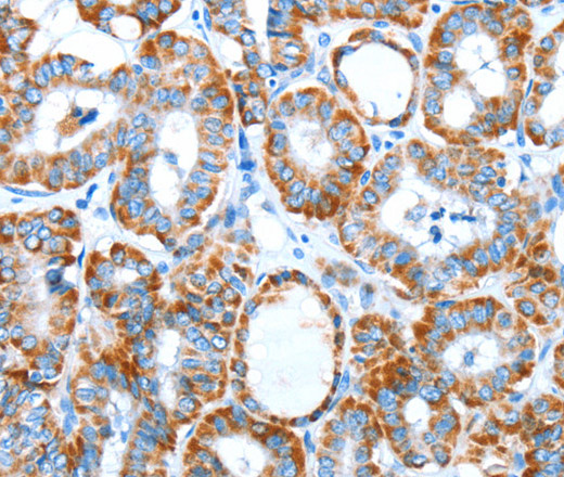 ALDH5A1 Polyclonal Antibody (E-AB-12961)