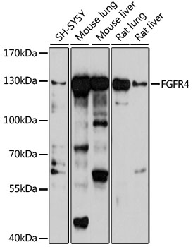 FGFR4 Polyclonal Antibody (E-AB-92780)