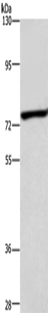 ABCB8 Polyclonal Antibody (E-AB-13887)