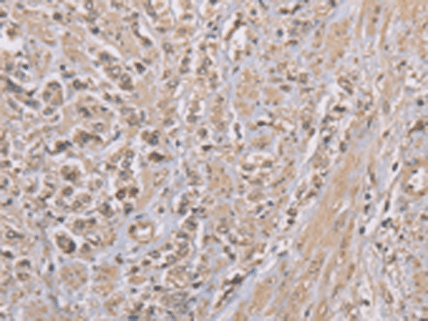 ZBTB2 Polyclonal Antibody (E-AB-53224)