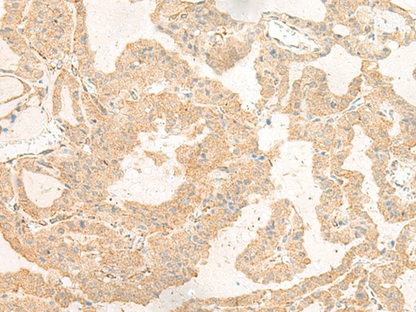 GNAT3 Polyclonal Antibody (E-AB-19920)