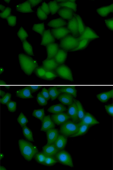 CAMK1 Polyclonal Antibody (E-AB-61472)