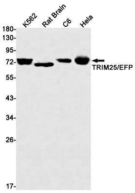 Recombinant TRIM25 Monoclonal Antibody (E-AB-81492)