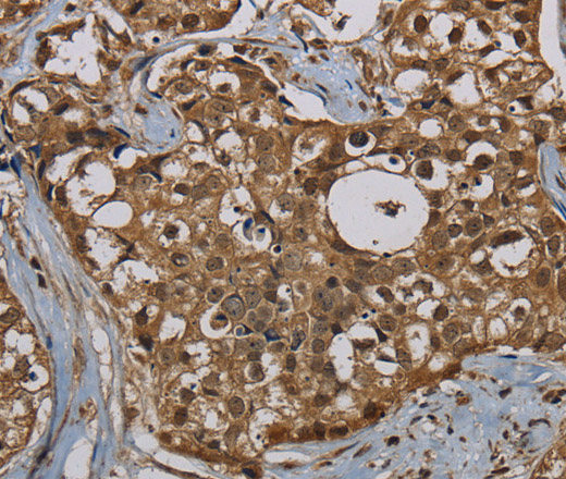 PNN Polyclonal Antibody (E-AB-13517)