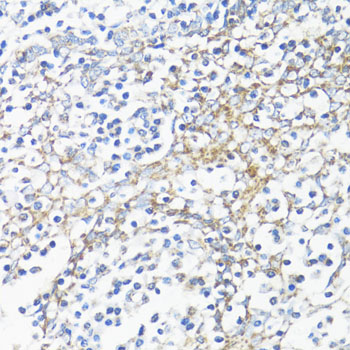 HSD17B10 Polyclonal Antibody (E-AB-60967)