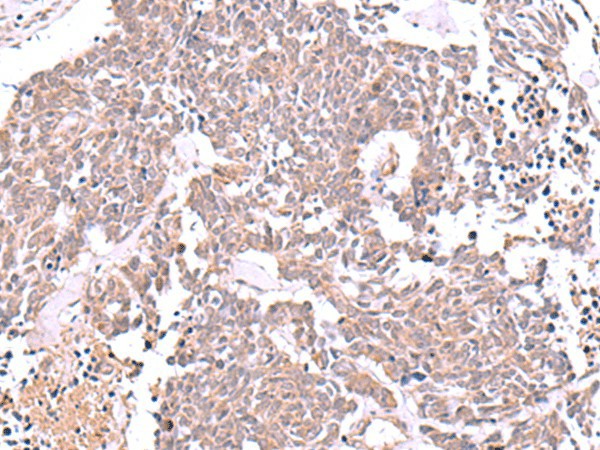 JDP2 Polyclonal Antibody (E-AB-18141)