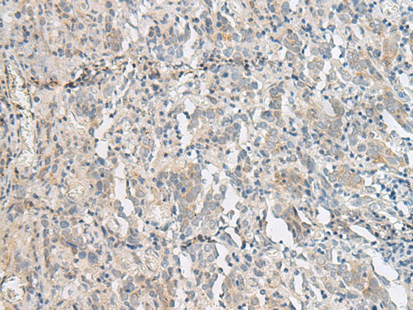 PCSK5 Polyclonal Antibody (E-AB-52778)