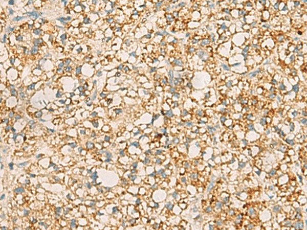 PDCL Polyclonal Antibody (E-AB-53133)