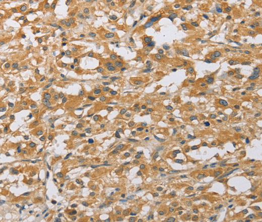 ARHGEF1 Polyclonal Antibody (E-AB-10832)