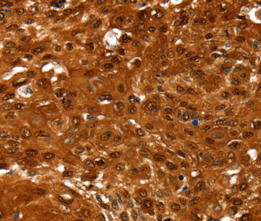NCOR1 Polyclonal Antibody (E-AB-12591)