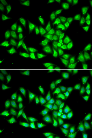 PCMT1 Polyclonal Antibody (E-AB-61295)