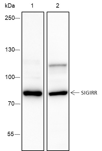 Recombinant SIGIRR Monoclonal Antibody (AN301657L)