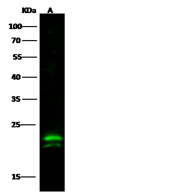 CMPK1 Monoclonal Antibody (AN200144P)