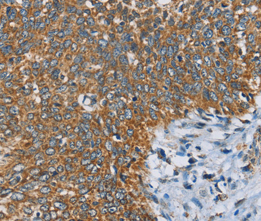 ANKHD1 Polyclonal Antibody (E-AB-10979)