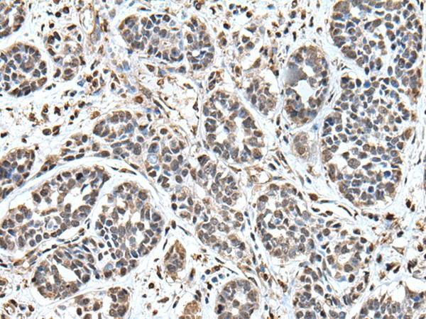UPK3A Polyclonal Antibody (E-AB-52444)