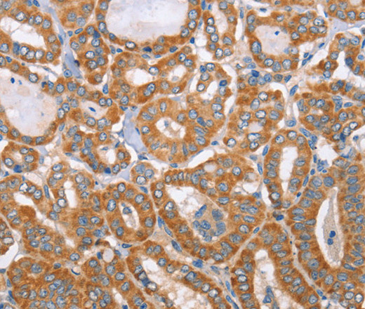 MTMR7 Polyclonal Antibody (E-AB-10890)