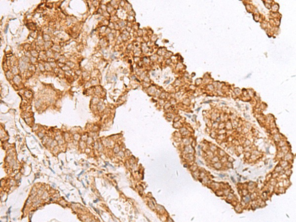 FAM200A Polyclonal Antibody (E-AB-19845)