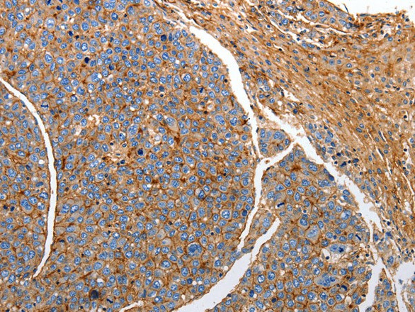 CD151 Polyclonal Antibody (E-AB-10262)