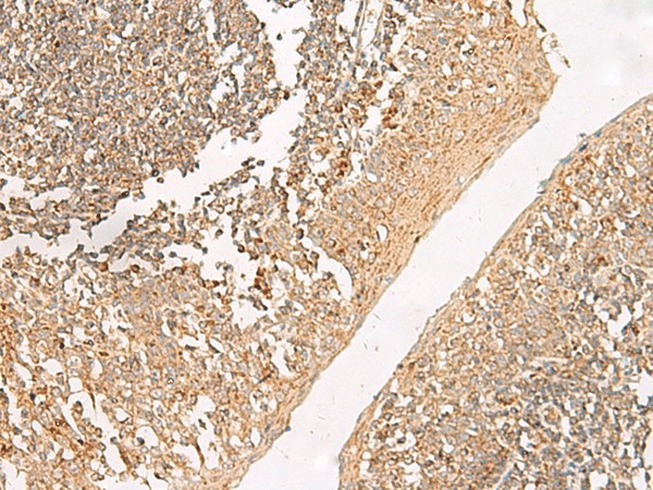 GRIK5 Polyclonal Antibody (E-AB-18058)
