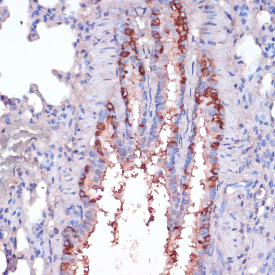 (KO Validated) RPL22 Polyclonal Antibody (E-AB-65613)