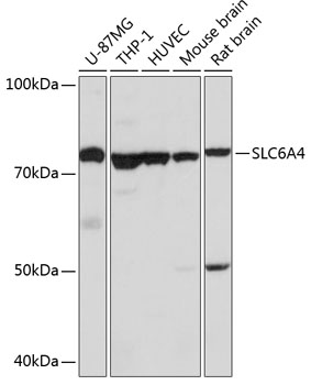 SLC6A4 Polyclonal Antibody (E-AB-64947)