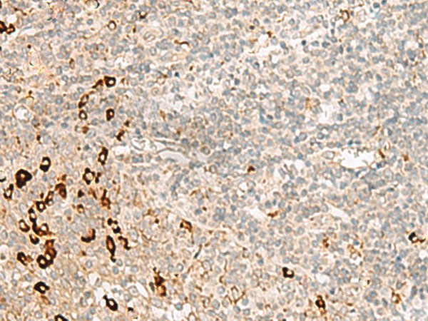 RMND5A Polyclonal Antibody (E-AB-18826)