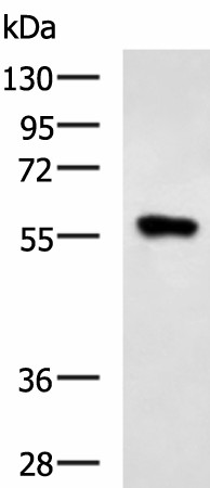 SQSTM1 Polyclonal Antibody (E-AB-19884)