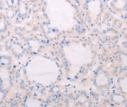 TSHR Polyclonal Antibody (E-AB-10668)