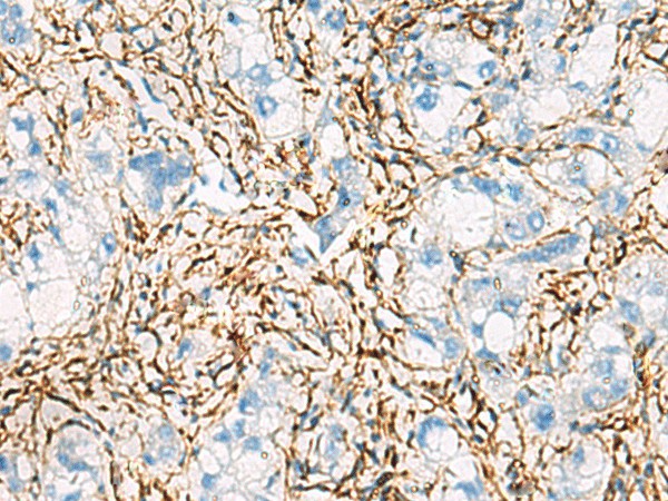 ACTC1 Polyclonal Antibody (E-AB-18696)
