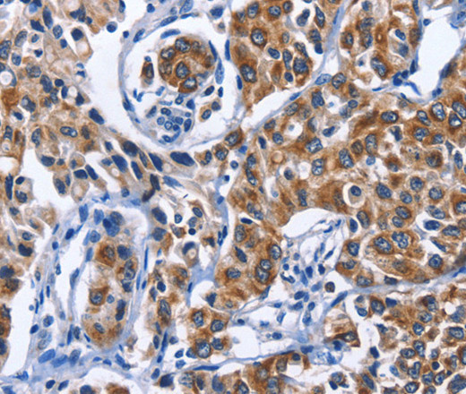 MYH1 Polyclonal Antibody (E-AB-14234)
