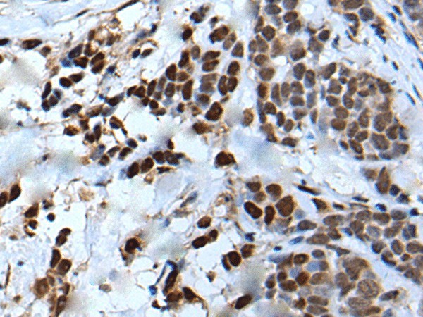 VEZT Polyclonal Antibody (E-AB-19591)