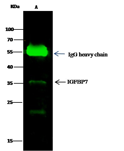 Recombinant IGFBP7 Monoclonal Antibody (AN300064P)