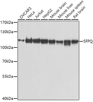 SFPQ Polyclonal Antibody (E-AB-62211)